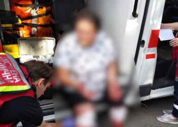 Собака напав та покусав мешканку Броварів