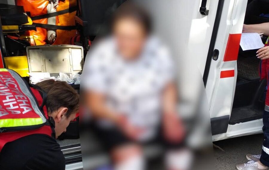 Собака напав та покусав мешканку Броварів