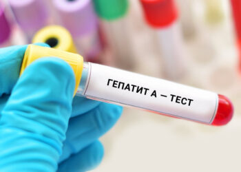 Спалаху вірусного гепатиту А на Київщині немає – брифінг КОВА (ВІДЕО)