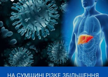Сумщина — лідер в Україні за показниками захворюваності на вірусний гепатит С – Суми та область