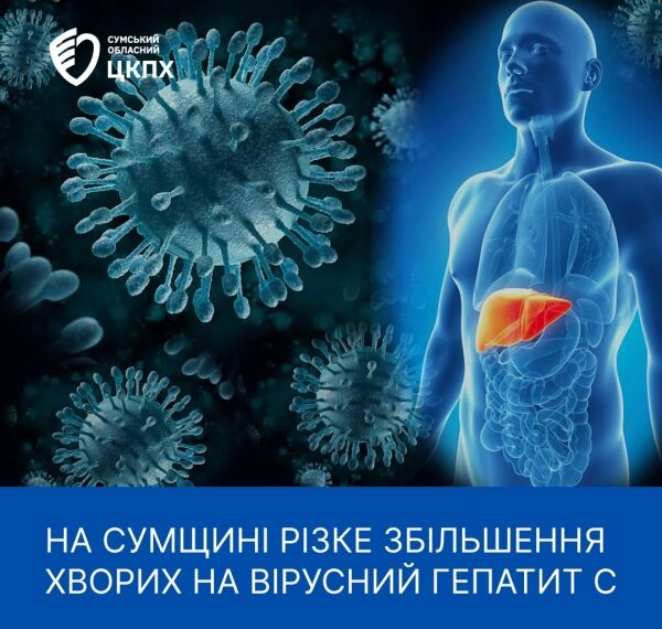 Сумщина — лідер в Україні за показниками захворюваності на вірусний гепатит С – Суми та область