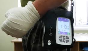 В Охтирці лікарі застосовують золотий стандарт – вакуумну терапію – Суми та область