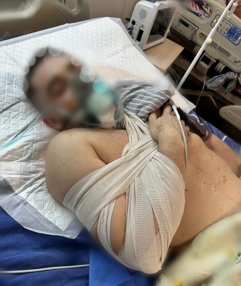 У Сумах рідні просять допомогти важко пораненому під час обстрілу поліцейському – Суми та область