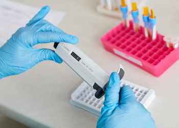 Аналіз на білірубін: що показує та коли призначають