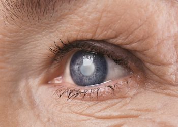 Основные причины и симптомы возрастных изменений зрения у взрослых