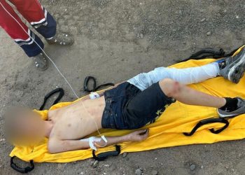 Под Одессой двое подростков забрались на крышу вагона ради фото и получили серьезные ожоги