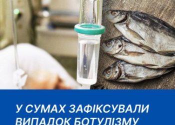 У Сумах зафіксований випадок ботулізму – Суми та область