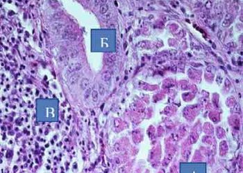 Остаточно діагностувати трансмісивний вірусний провентрикуліт у птиці допомагає гістологічне дослідження – Економіка
