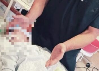 В Одессе сделали уникальную операцию на сердце шестимесячному мальчику