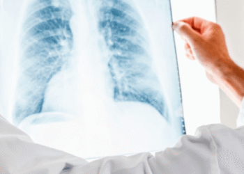 У Лебедині зафіксували випадок турберкульозу | Суми та область