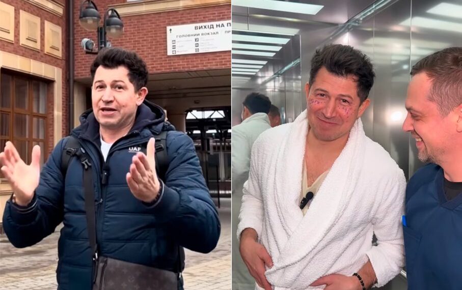 На порозі 50-річного ювілею Андрій Джеджула змінив форму очей: повіки тепер не нависають | Шоубизнес