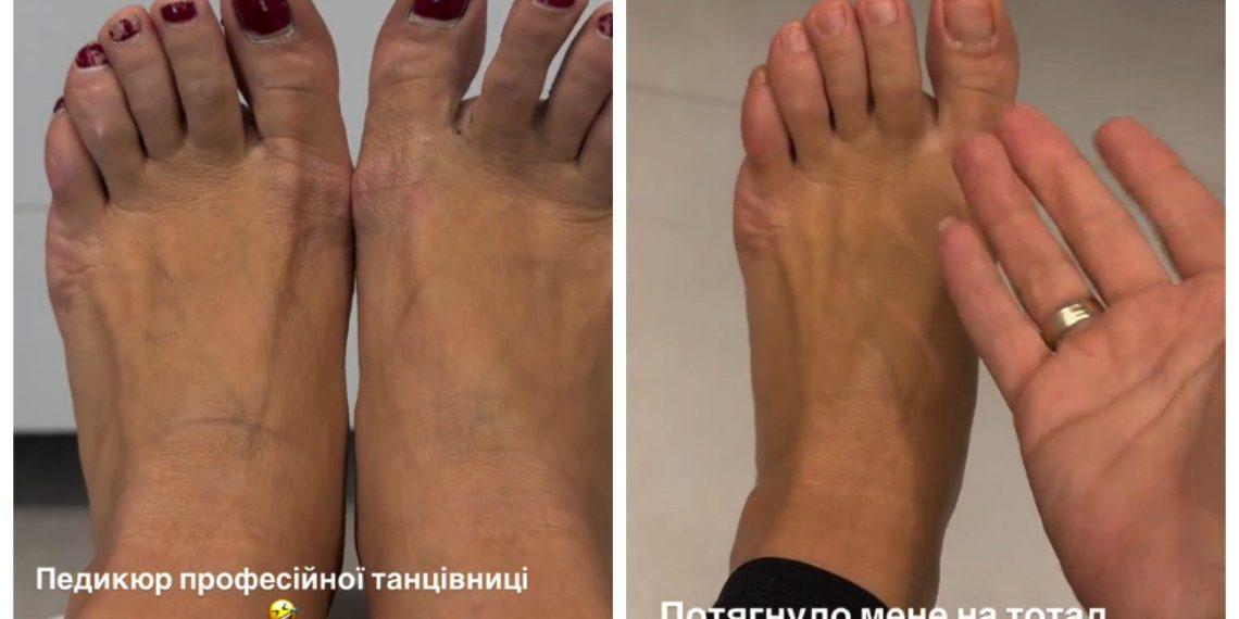 Це – не ноги принцеси: Ілона Гвоздьова показала “педикюр”, який собі не зробить жодна українка (ФОТО) | Шоубизнес