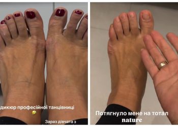 Це – не ноги принцеси: Ілона Гвоздьова показала “педикюр”, який собі не зробить жодна українка (ФОТО) | Шоубизнес