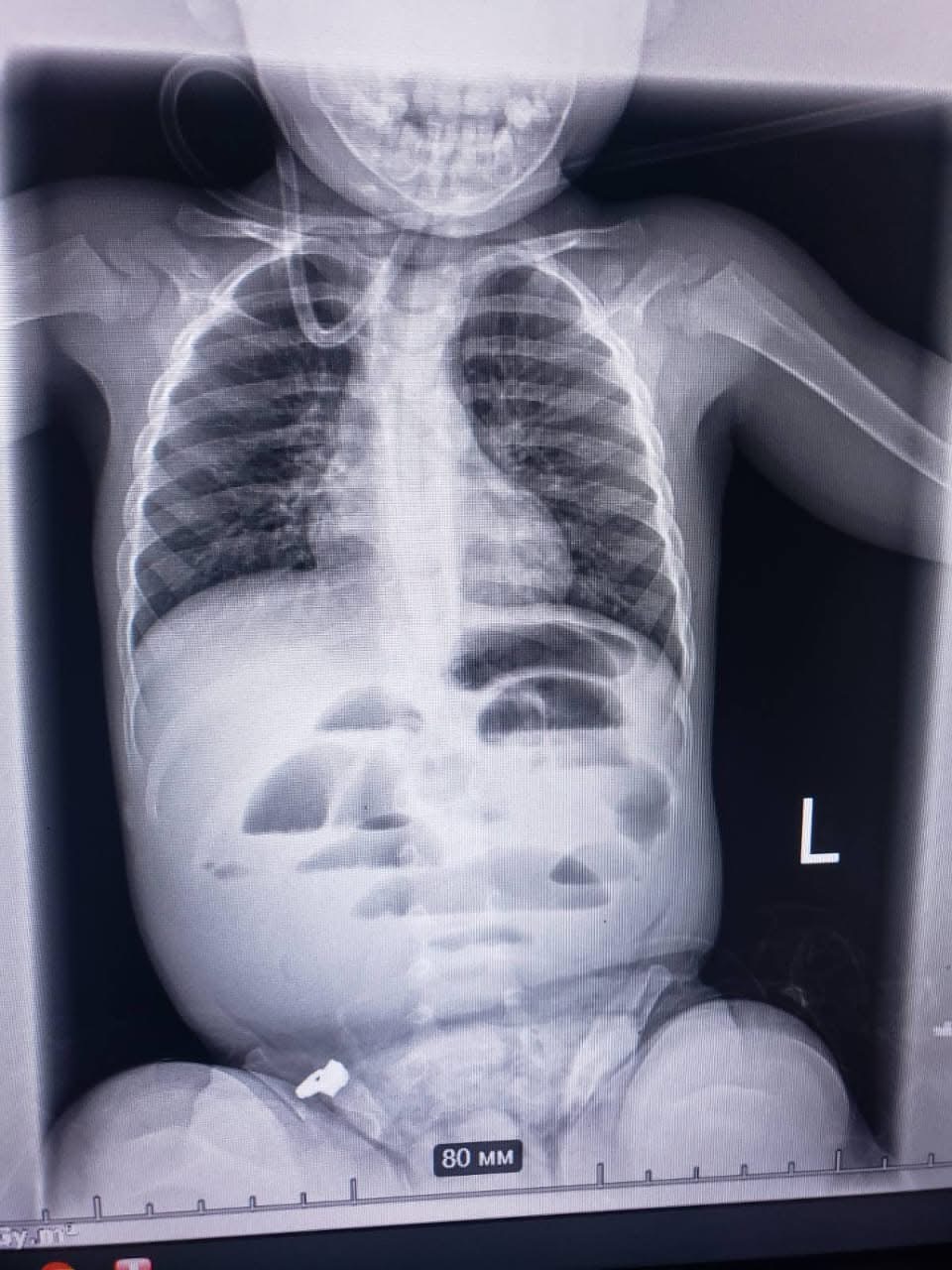 Гідрогелева кулька 