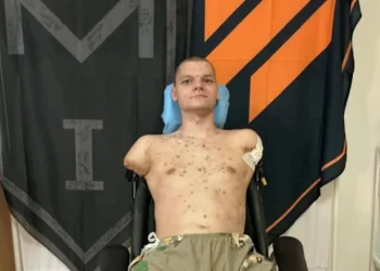 У «ПриватБанку» відмовилися видати картку бійцю без рук: реакція НБУ та позиція банку